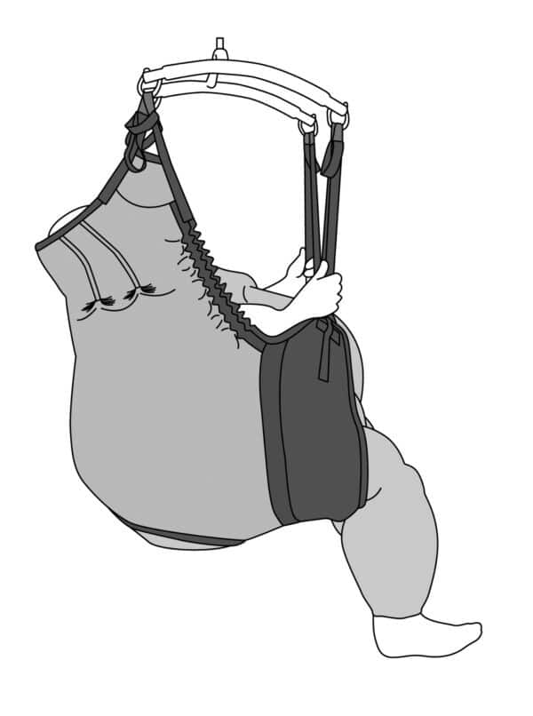 Bariatric In Situ Hammock Short Tucks Illustration