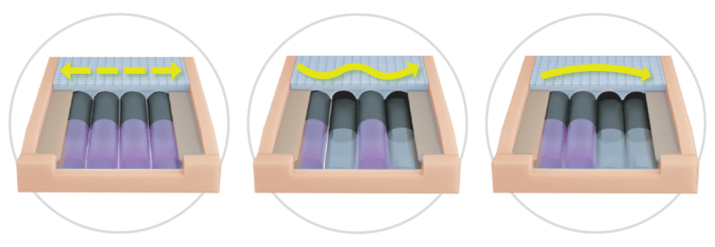 PG APM i Treatment Flexibility